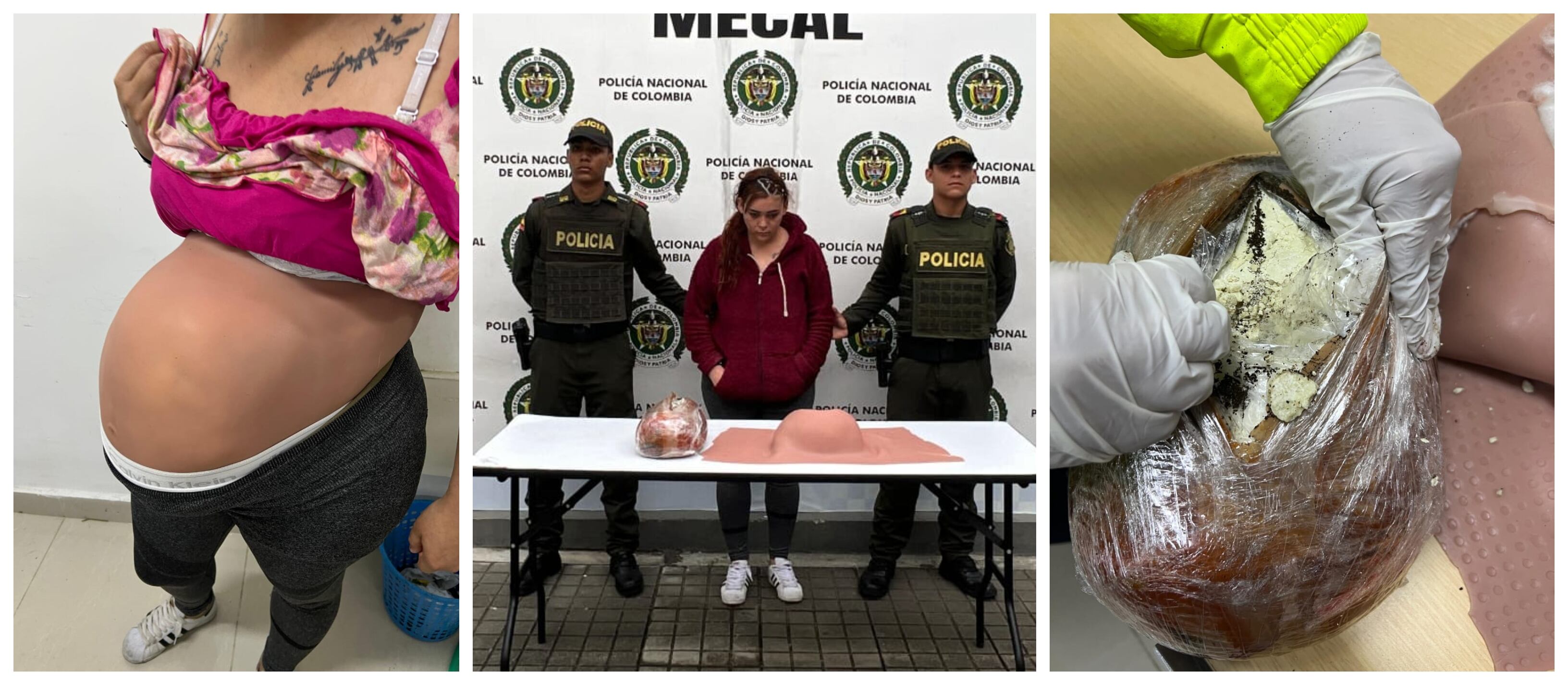 Narcos compran falsos vientres en el exterior para traficar en Colombia, denuncia la Policía de Cali.