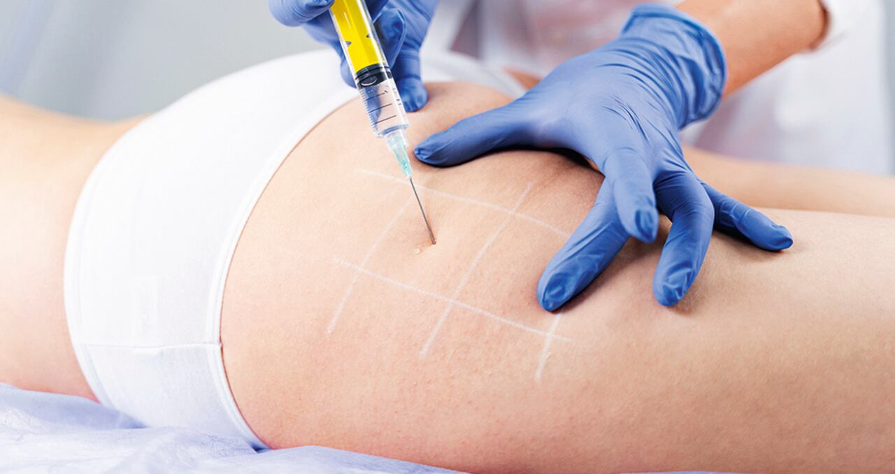 “Los pacientes antes de un procedimiento estético deben saber qué les aplicarán y en qué cantidad”: Lina triana, médica.