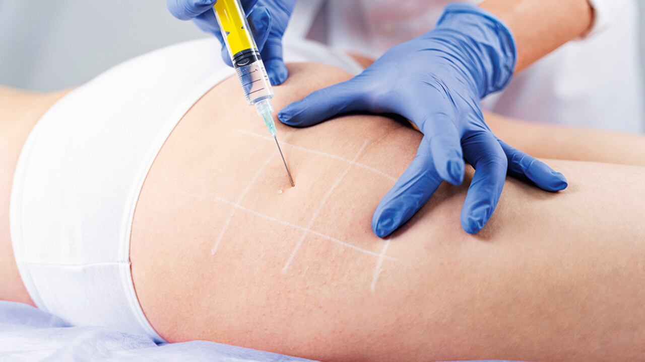 Quienes apliquen biopolímeros en una cirugía plástica podrían ir a la cárcel.