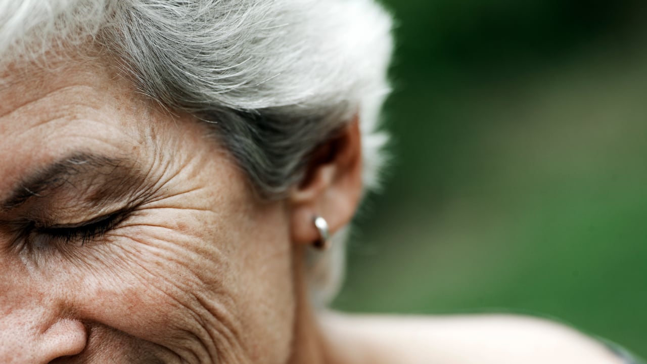 Las arrugas son signos de la edad.