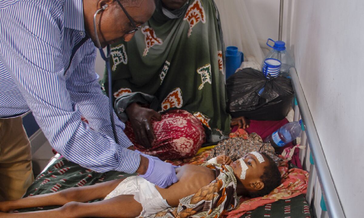 Los niños son los principales afectados por la hambruna en Somalia. ONU advierte que, debido a la explosión de crisis en el mundo, le que quedado difícil ayudar como es necesario en todos los países que lo requieren.