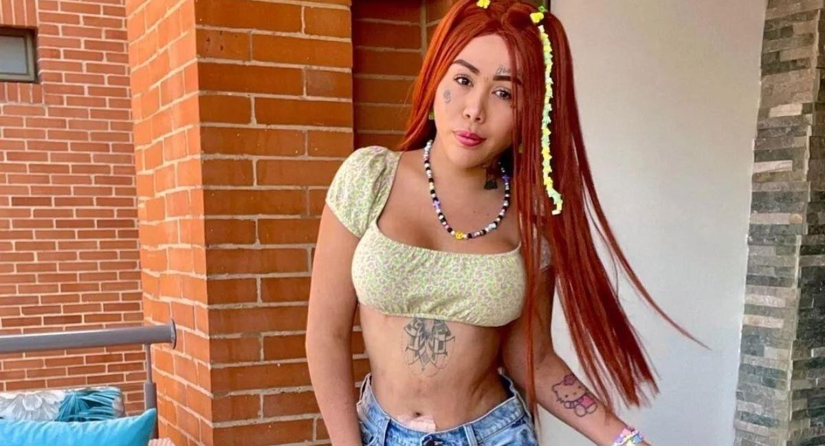 Yina Calderón inició un proceso estético para eliminar los tatuajes que no le permiten sentirse cómoda.