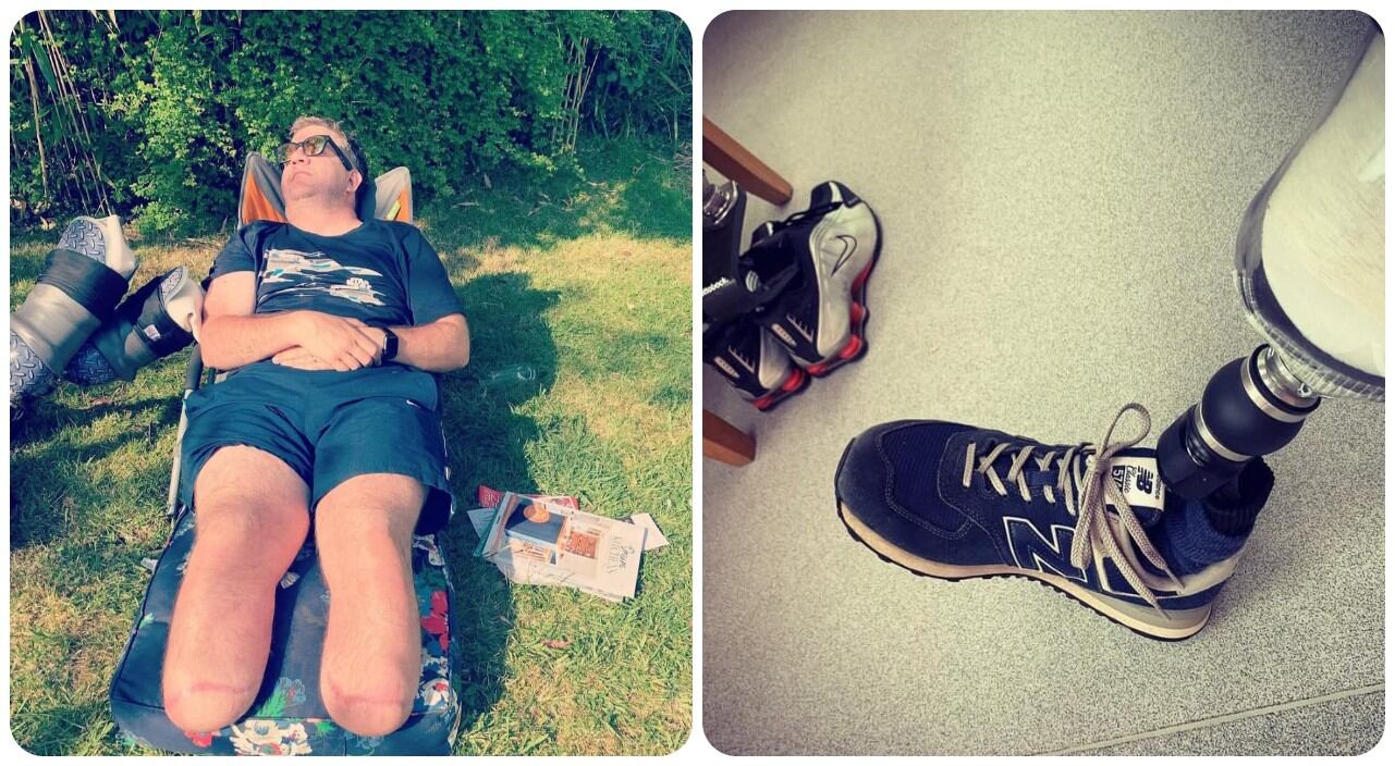 Cirujano irá a la cárcel por amputarse sus propias piernas