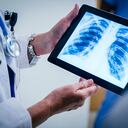 En el caso de niños, los médicos recurren a una radiografía de tórax y una espirometría, para encontrar la causa de la tos crónica.