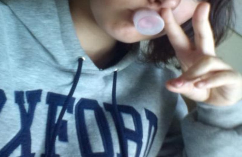 En la imagen se evidencia el método con el que los jóvenes deforman sus labios. 