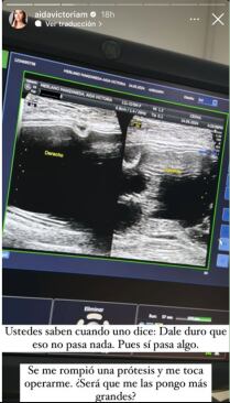 Foto: Captura de pantalla / Instagram @aidavictoriam