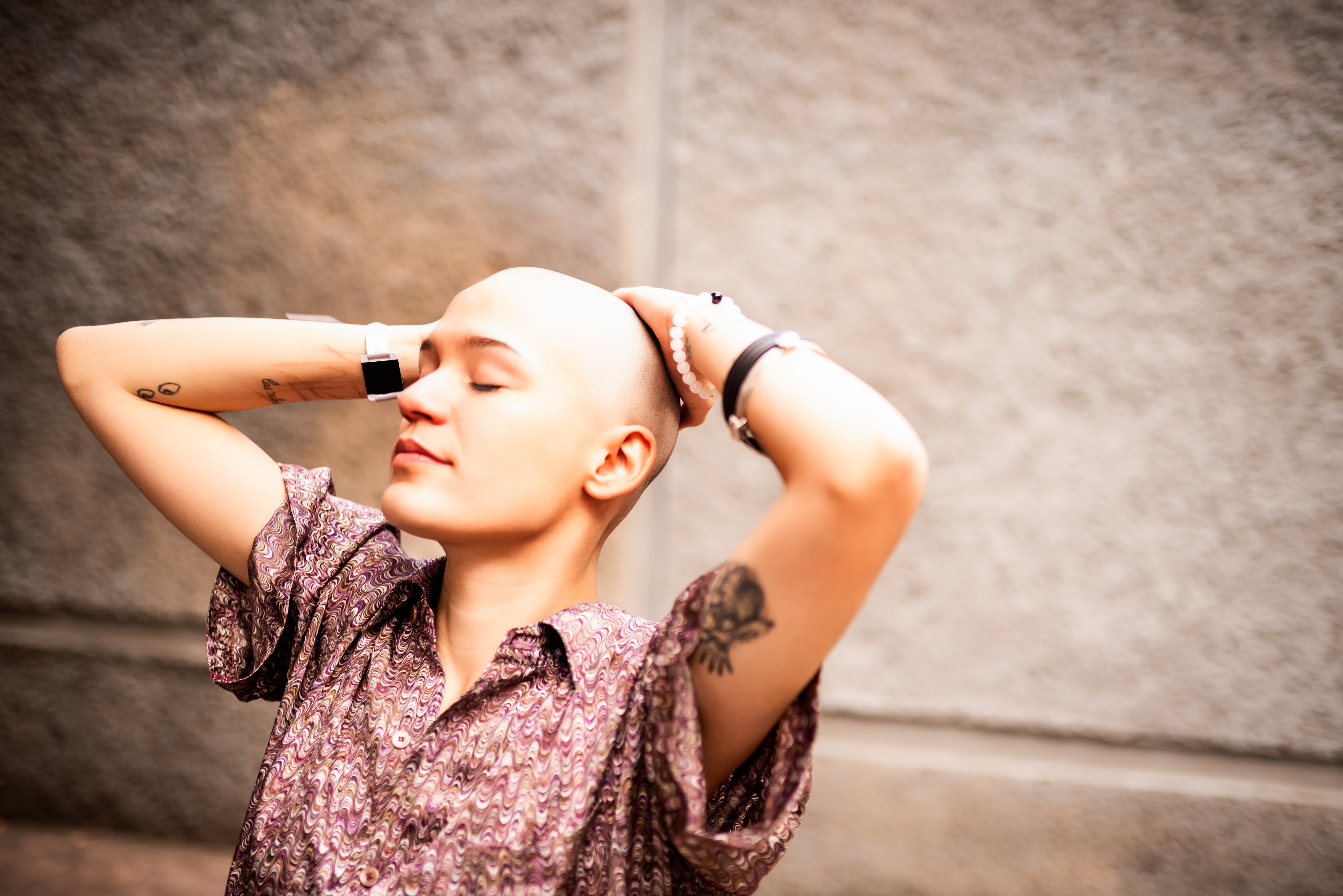 Alopecia en las mujeres
