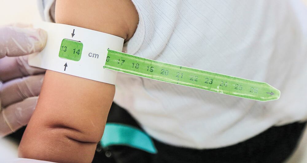 Los reportes de niños que en los últimos cinco años han padecido el hambre aguda son de 10.709. 