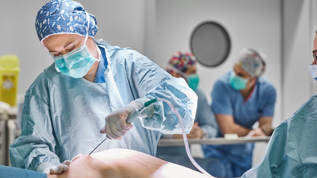 La liposucción es una cirugía estética muy común que puede practicarse en diferentes partes del cuerpo según cada paciente lo necesite. Foto: Getty