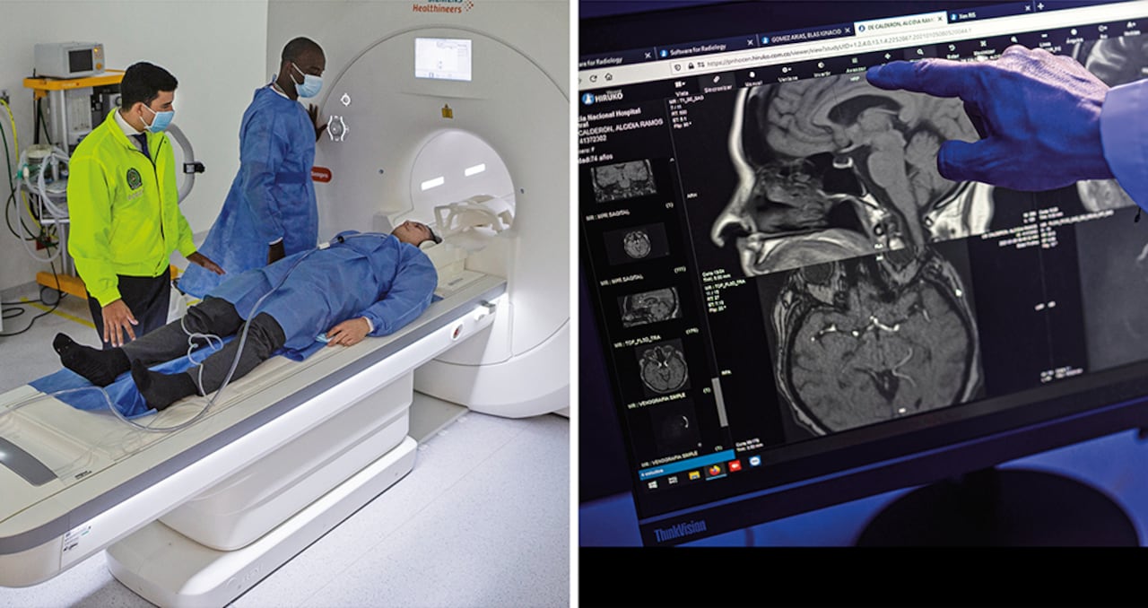 Armados con tecnología de punta que incluye tomógrafos, aparatos portátiles de ondas cerebrales y softwares, los científicos de la Policía Nacional iniciaron un proyecto de investigación en 2018. Desde entonces han analizado decenas de cerebros.