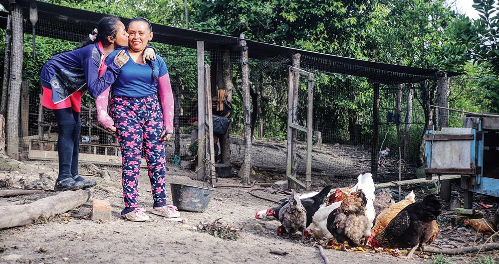   Aunque nació en Cácota, desde hace ocho años vive en Toledo. Alicia tiene dificultad para poder agarrar algunas cosas por la condición de sus manos.