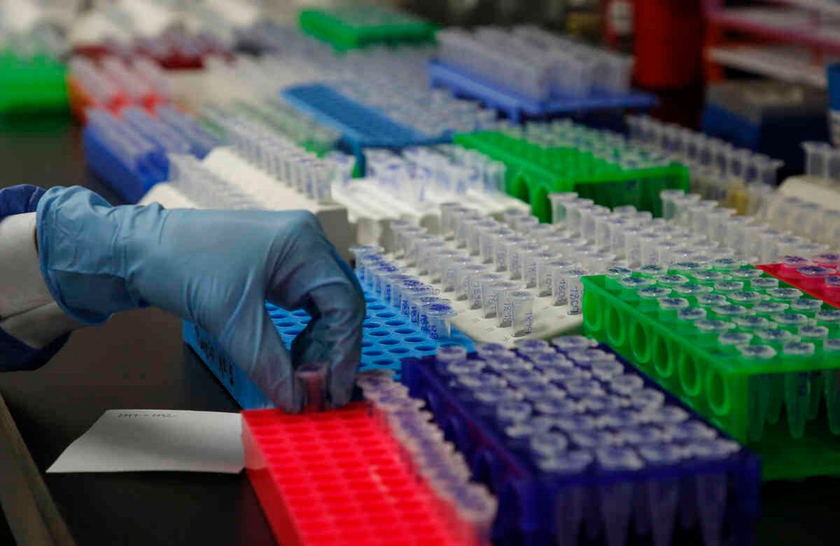 Estos test funcionan con una muestra de sangre y en 15 minutos es posible saber si la persona ha estado infectada o no. Cortesía Universidad El Bosque Foto: Guillermo Torres.