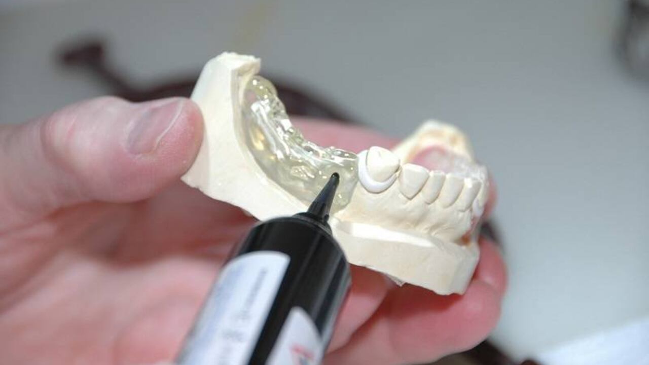 Para que el absceso se abra y se pueda drenar el pus, es importante aplicar compresas de agua tibia sobre el mismo.