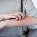 La picazón en la piel puede ser causada por varios factores.