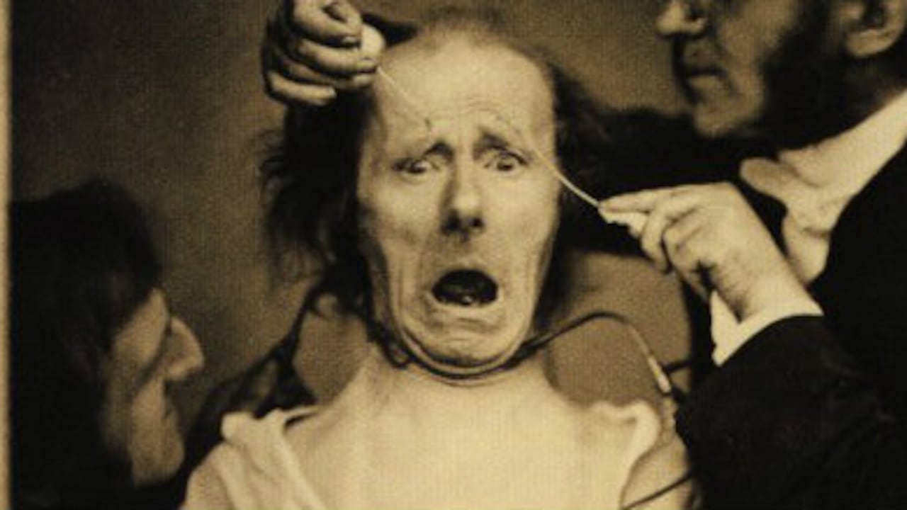 Experimento en el siglo XIX por el médico francés Duchenne de Boulogne para provocar y medir emociones en un paciente.