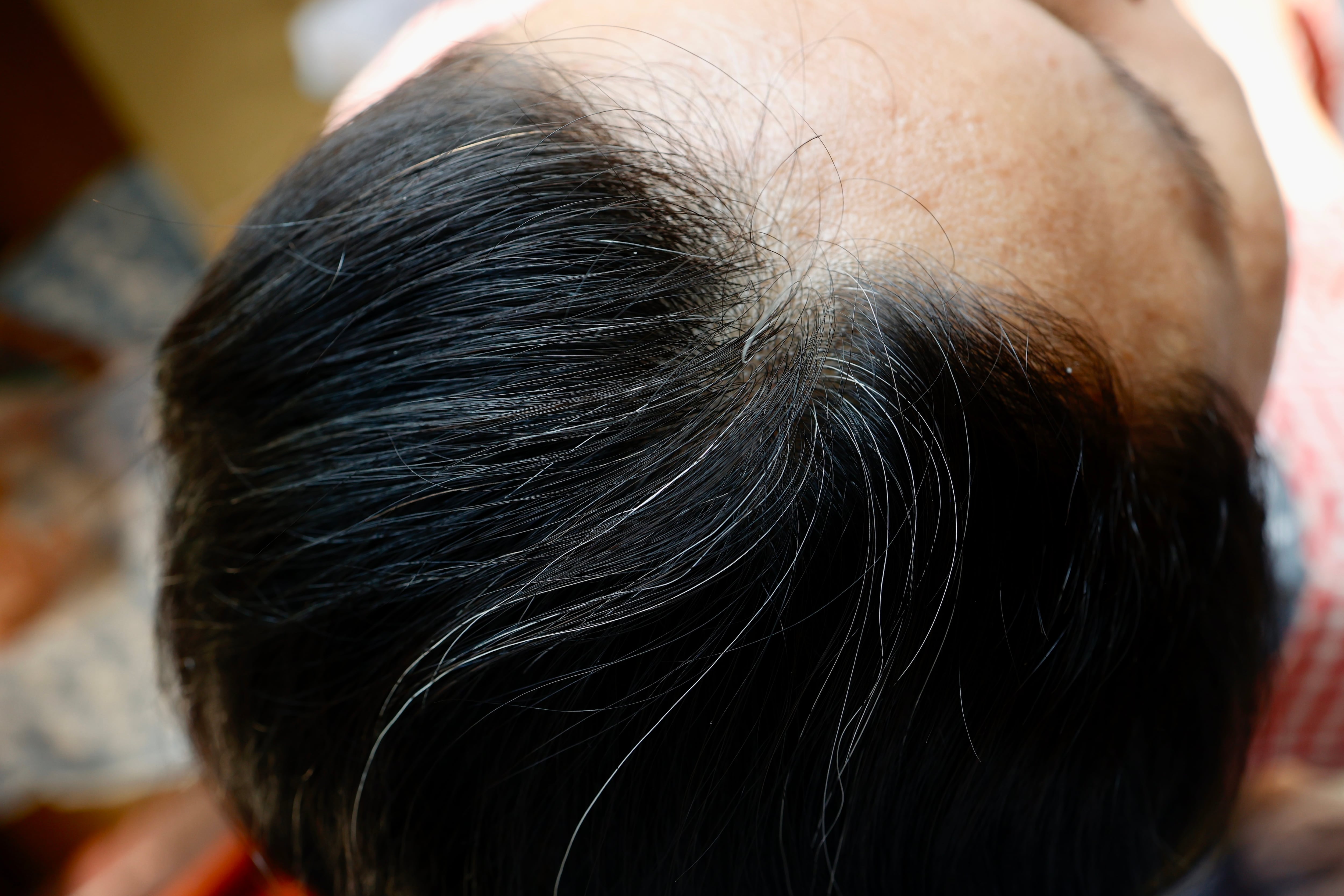 Las canas también se pueden presentar antes de los 30 años de edad.