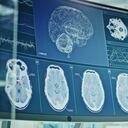 Pantallas de ordenador en laboratorio. Exploraciones cerebrales e investigación de coronavirus