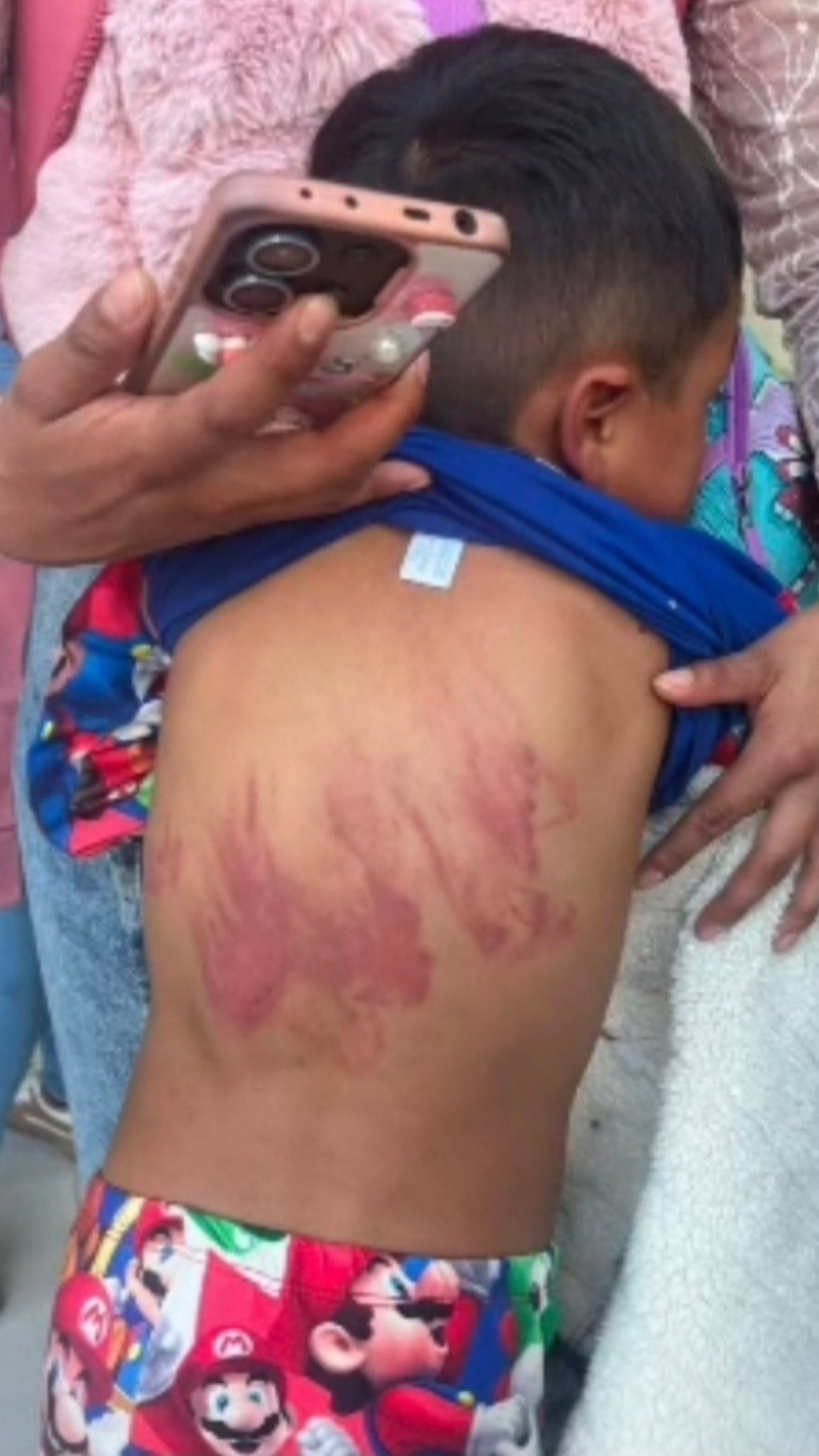 Investigan caso de agresión física contra un menor de seis años en Ciudad Bolívar
