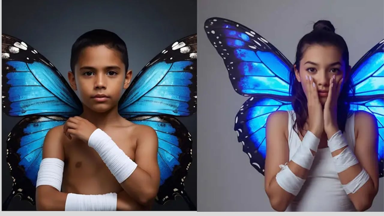 Piel de mariposa.