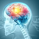 Células cancerosas atacando un cerebro humano. ilustración 3d