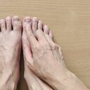 Descubra el secreto detrás de la cura de las uñas encarnadas.