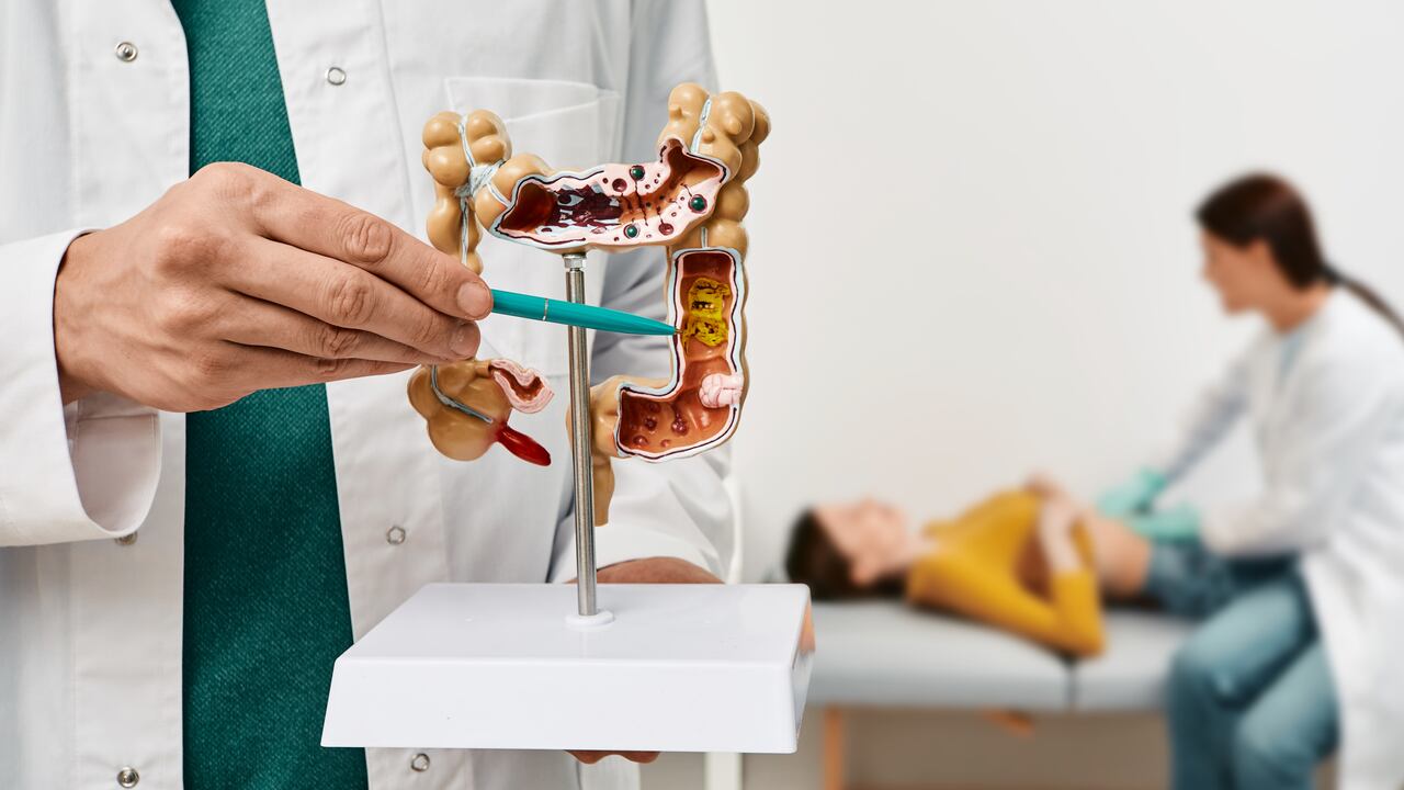 En el 2020 se registró más de 10 millones de defunciones a causa de cáncer.