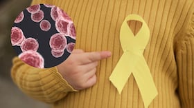 Especialistas advierten sobre el sarcoma: estos son los síntomas que requieren atención médica.