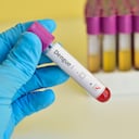 El diagnóstico de dengue requiere de un examen de laboratorio.