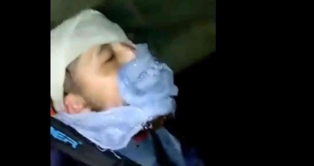 El joven fue llevado a un hospital tras el ataque y allí le confirmaron la triste noticia.