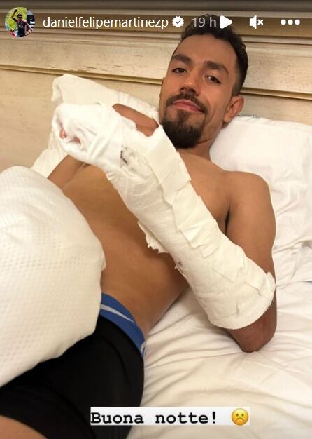 Daniel Felipe Martínez mostró cómo quedó tras una posible caída.