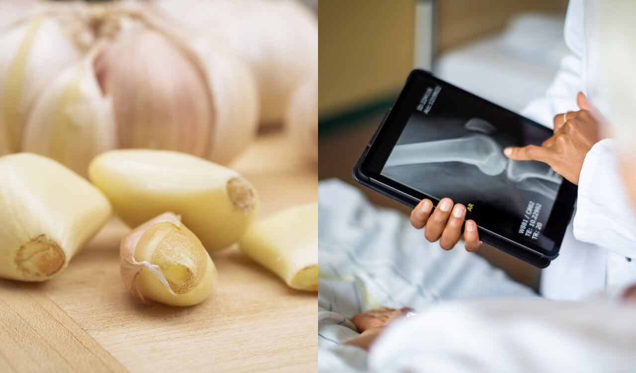 Ajo, huesos, sistema óseo