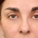 Las ojeras son manchas oscuras que se generan en la parte inferior de los ojos, las cuales aparecen a los lados de la nariz.