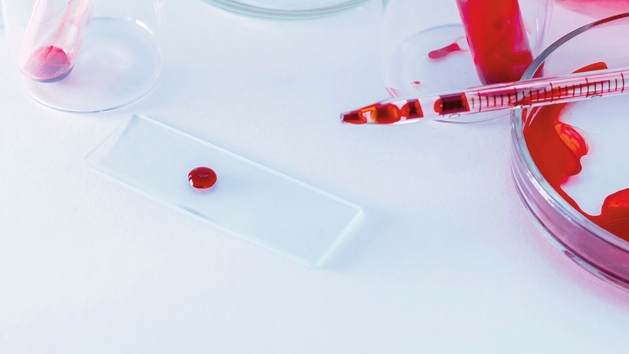 Los pacientes hemofílicos presentan problemas de coagulación de la sangre. 