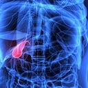 Los cálculos biliares son depósitos endurecidos de fluido digestivo que se pueden formar en la vesícula.