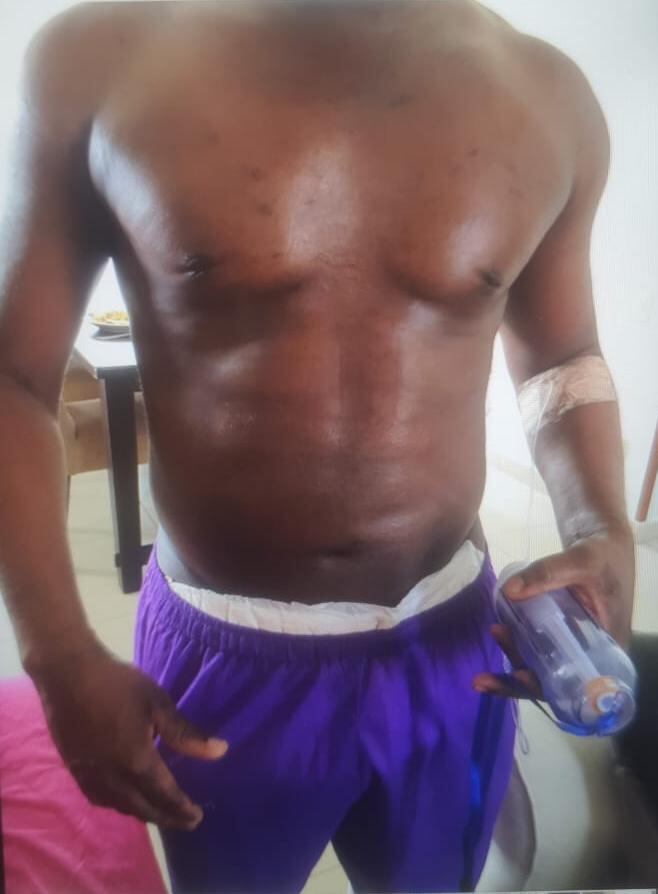 Alias Matamba se realizó varias cirugías estéticas