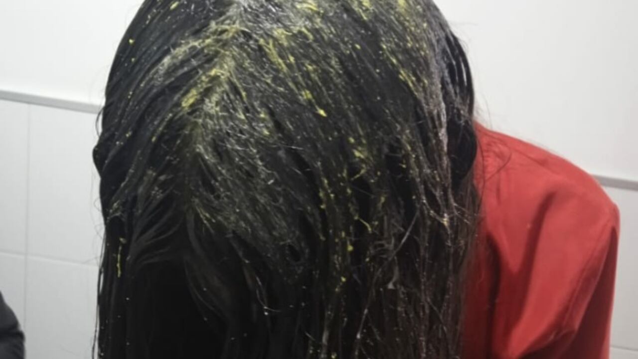 En video de cámaras de seguridad quedó en evidencia el brutal ataque con pegante que un hombre, que aún se desconoce su identidad, hace contra una joven, mientras caminaba con una amiga por las calles de un barrio residencial de Manizales.