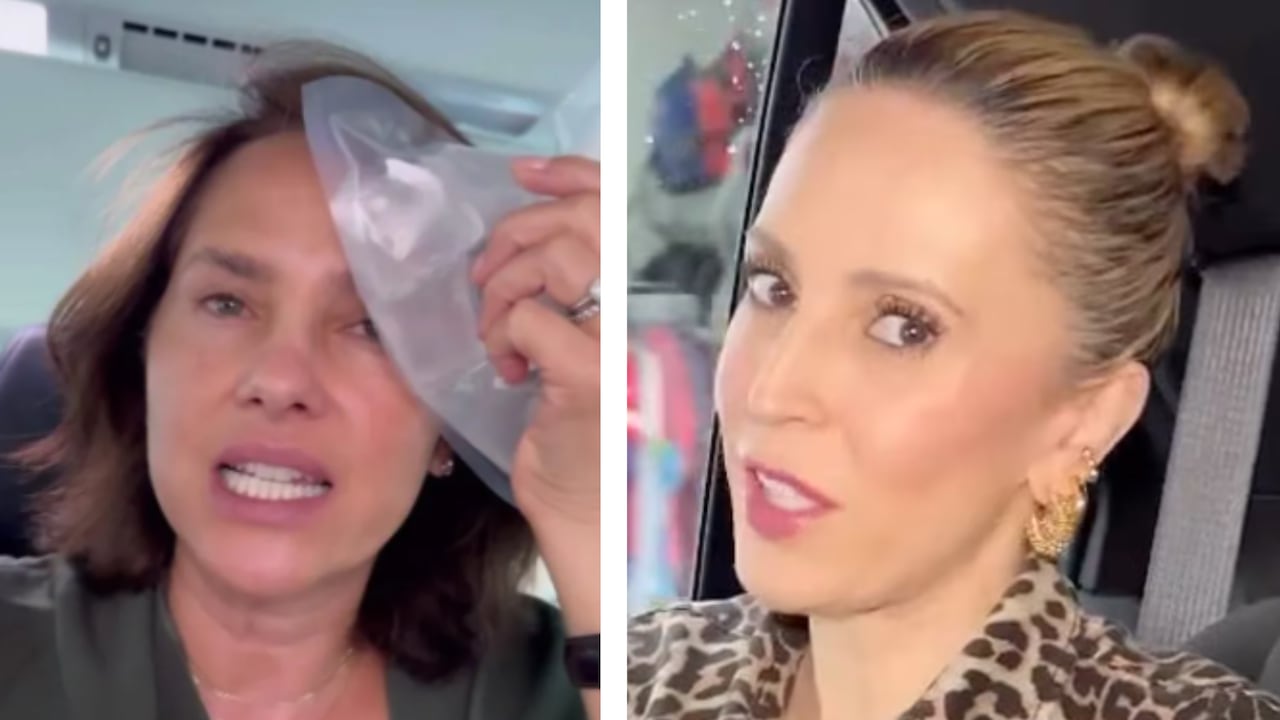 Paola Turbay sufrió accidente que dejó marca en su rostro