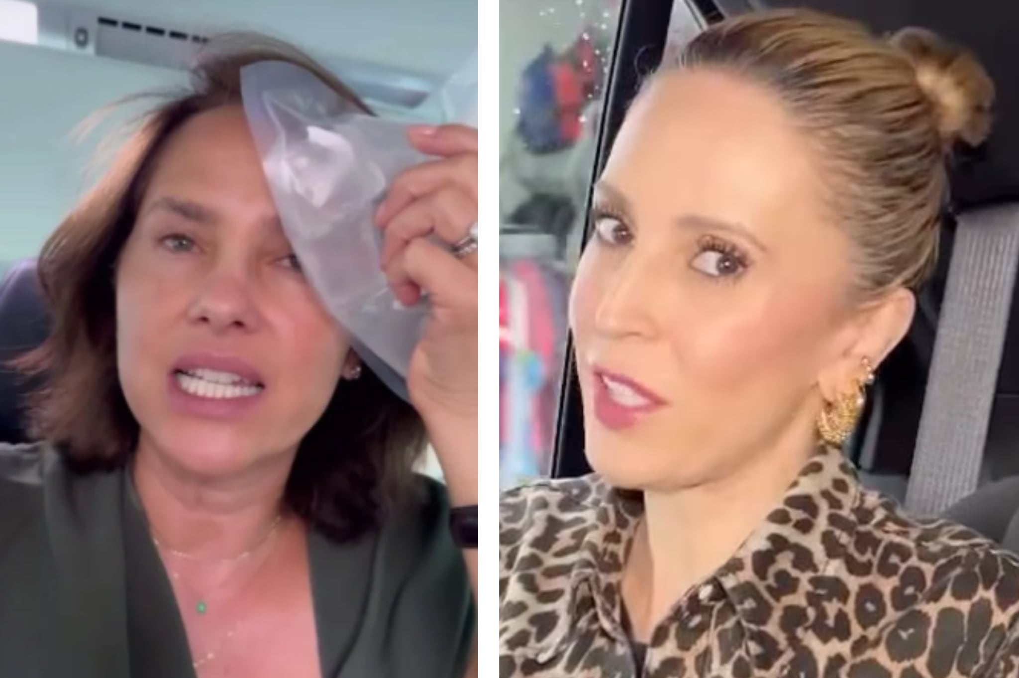 Paola Turbay sufrió accidente que dejó marca en su rostro