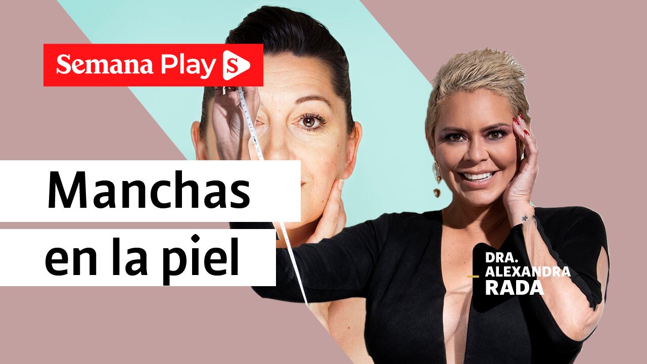 Manchas en la piel | Dra. Alexandra Rada en EstéticaMENTE