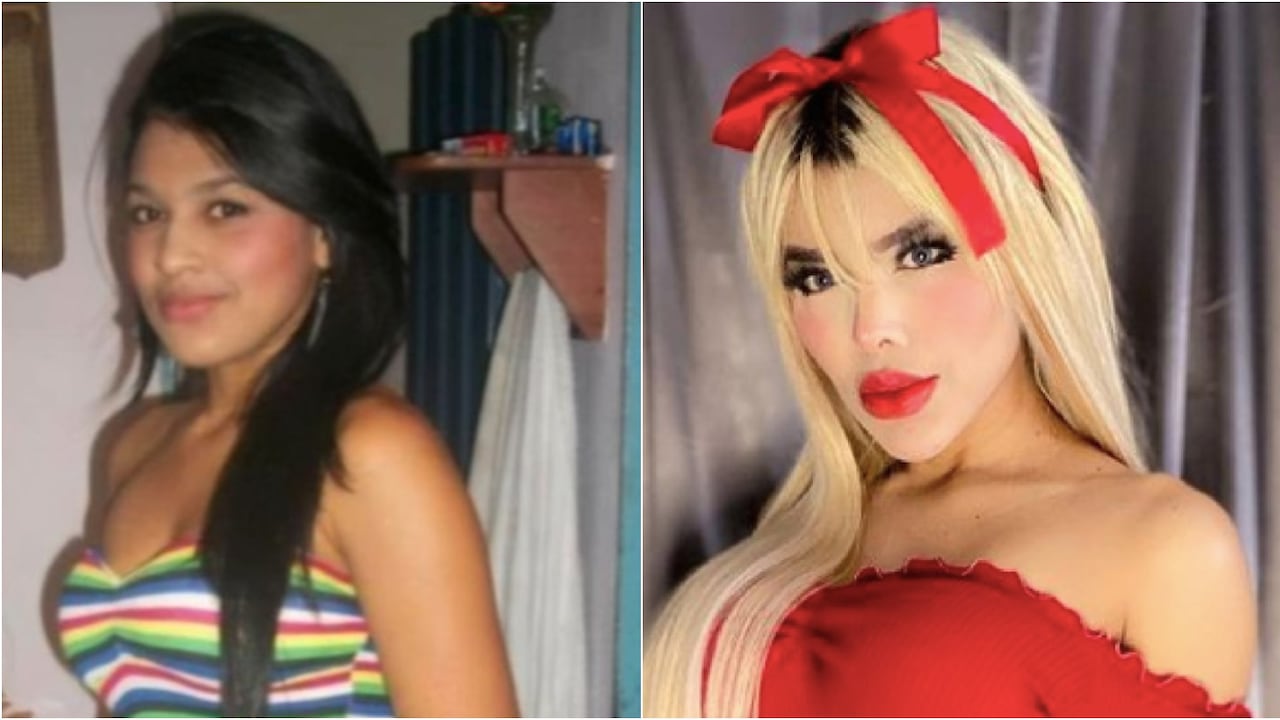 Antes y después de La Barbie Colombiana