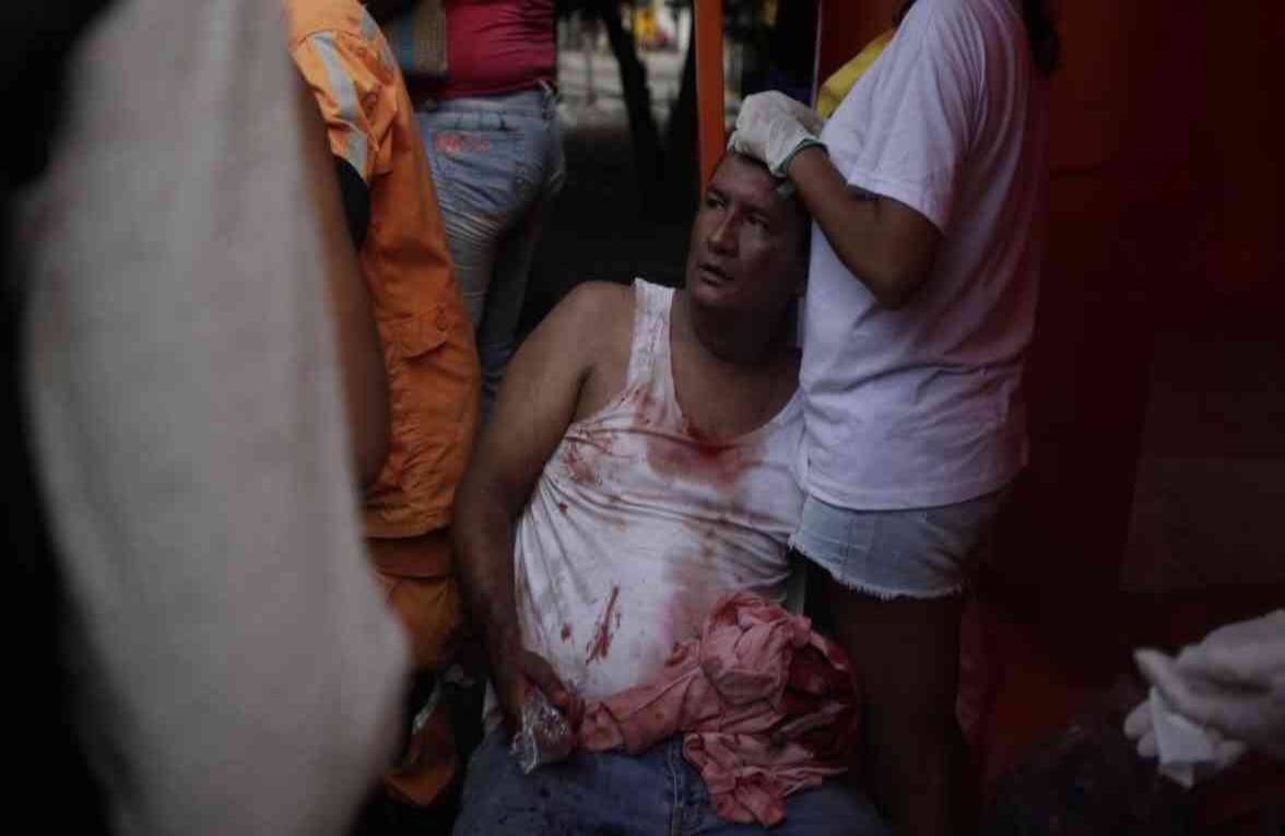 Este hombre resultó herido al momento en que fueron incinerados los camiones. Foto: Diana Rey Melo SEMANA