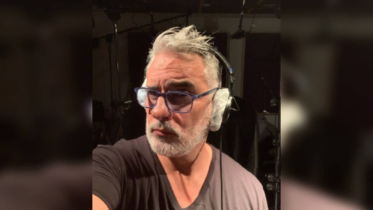 “Que no tengan miedo, que se aventuren, que se diviertan haciéndolo como yo me estoy divirtiendo", dijo el actor sobre su cirugía. Foto Instagram @soyvaroni.