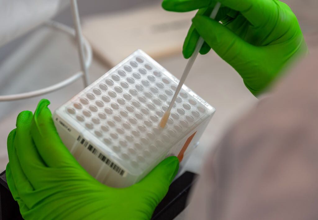 Trasplante de células madre sanguíneas y médula ósea.