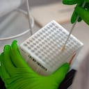 Trasplante de células madre sanguíneas y médula ósea.