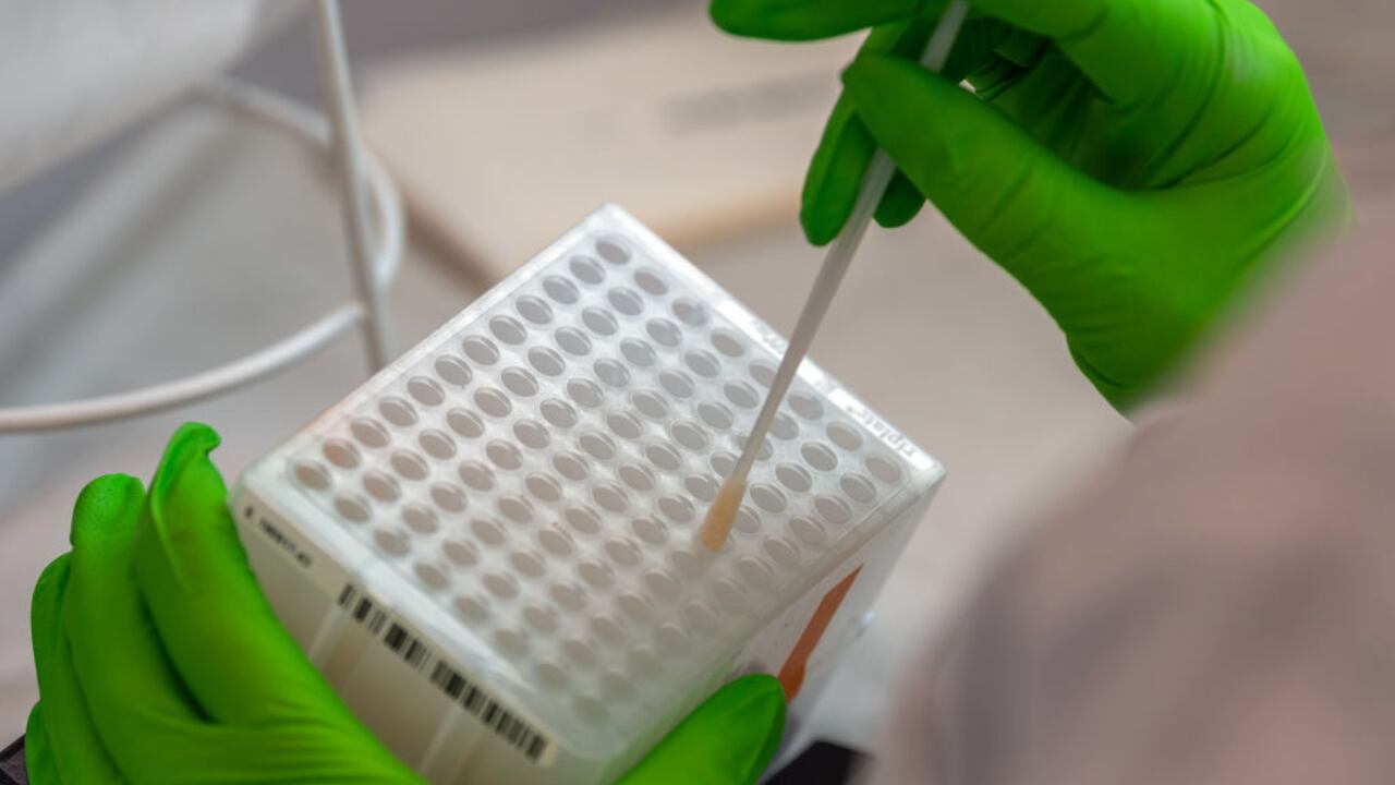 En marzo, los cirujanos del Mass General Hospital (MGH) realizaron durante unas cuatro horas una intervención inédita en el mundo en este hombre de 62 años que sufría una enfermedad renal en fase terminal.