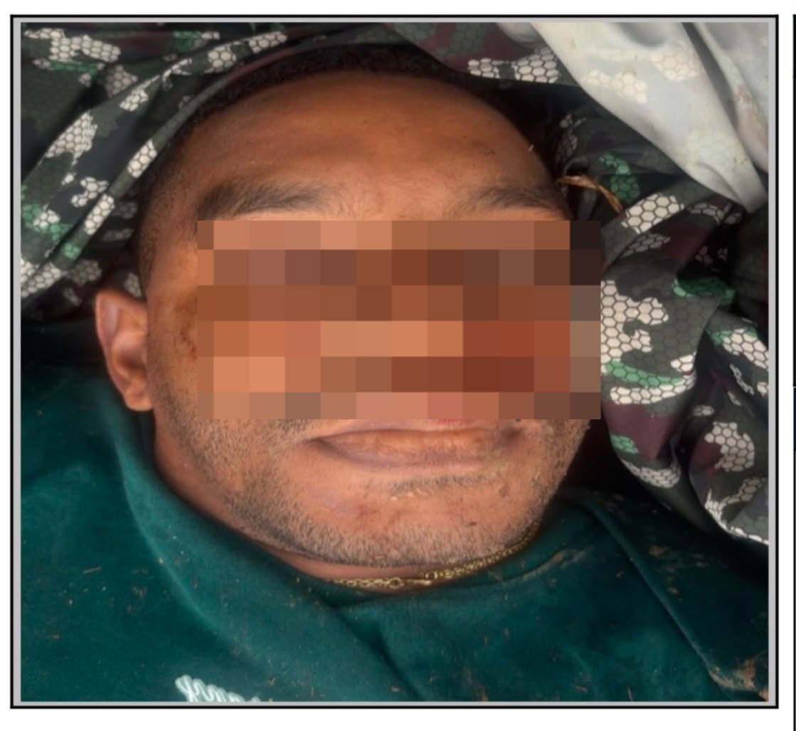 Alias Niche tras ser abatido por el Ejército Nacional.