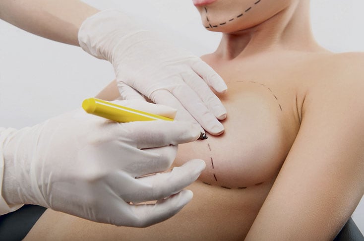 En casos donde el seno sea pequeño y cuente con poco tejido mamario, lo más recomendable desde una perspectiva estética es considerar la colocación de un nuevo implante. Sin embargo, si la paciente presenta un busto caído y flácido, pero aún cuenta con tejido, es posible reconstruir el seno utilizando una técnica de mamoplastia con pedículos y grasa sin prótesis mamaria.