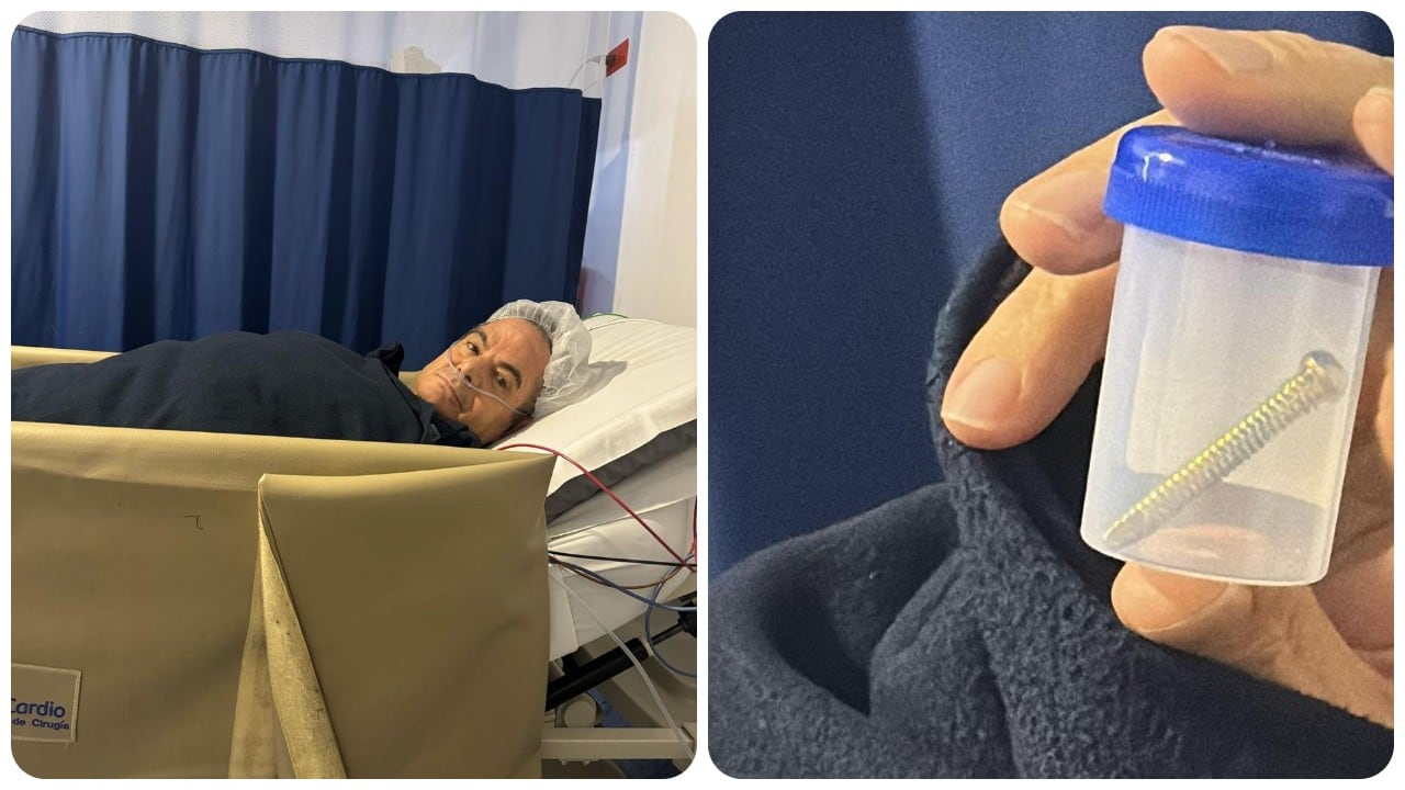 El exvicepresidente Germán Vargas Lleras mostró el tornillo que le extrajeron de su rodilla.