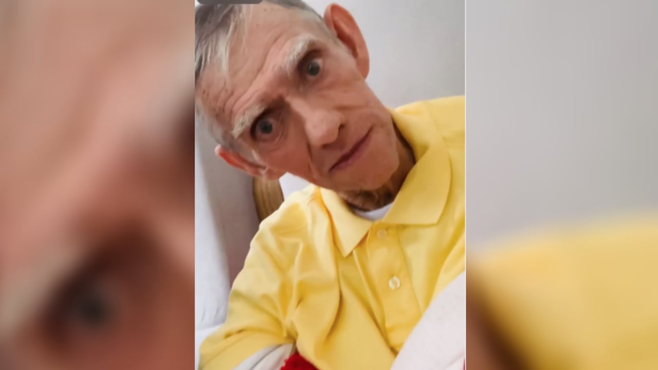 Mandíbula comediante