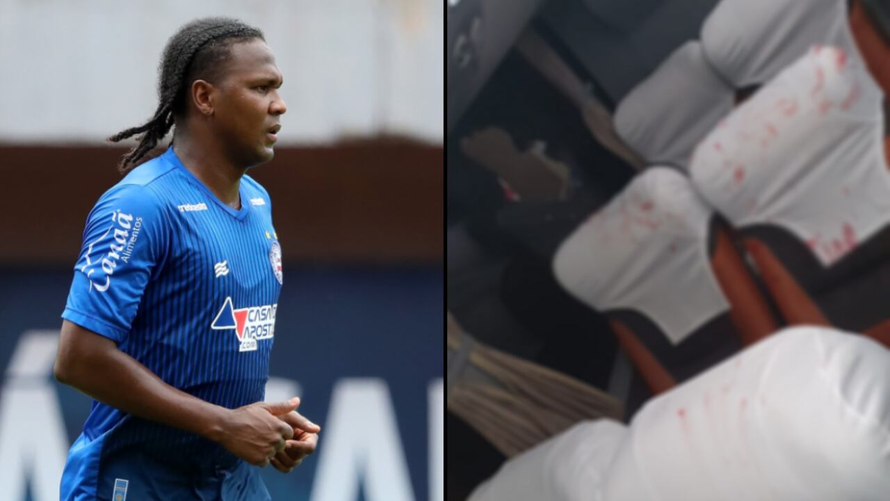 El club del colombiano sufrió un fuerte ataque en Brasil.